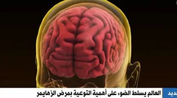 أحد أشكال الخرف شيوعا.. ألزهايمر يؤثر على ملايين الأشخاص بالعالم - تقرير