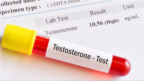 المستوى الطبيعي “لهرمون الذكورة” لدى الرجال في سن الـ50 – التقرير