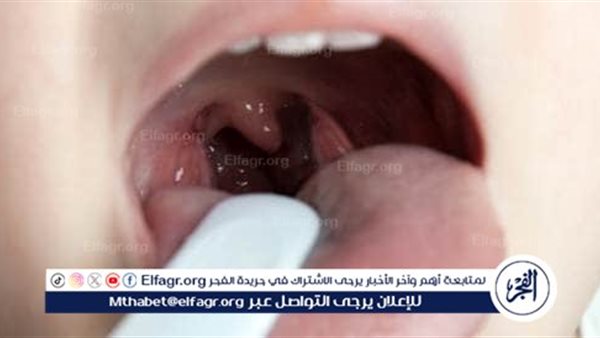 الوقاية من احتقان الزور وأهميتها لصحة الجهاز التنفسي – التقرير